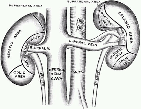 Kidney Stone