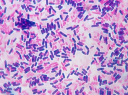 Gram staining