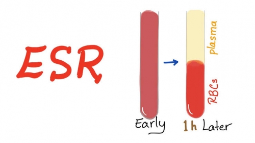 Erythrocyte sedimentation rate