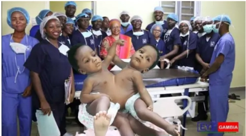 Nigerian Doctors Who Separated Conjoined Twins Set To Be Honoured