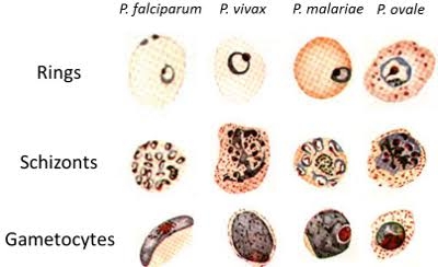 Malaria parasite test