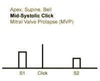 Heart sounds 04 Apex, Bell Mid Systolic Click, Supine, Mitral Valve Prolapse.mp3