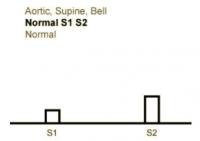 Heart Sounds 14 Aortic, Supine, Bell, Normal S1 and S2, Normal heart sounds.mp3